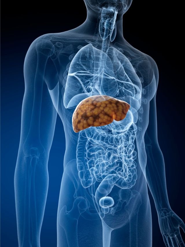 Read more about the article 5 Foods for a Healthy Fatty Liver Diet